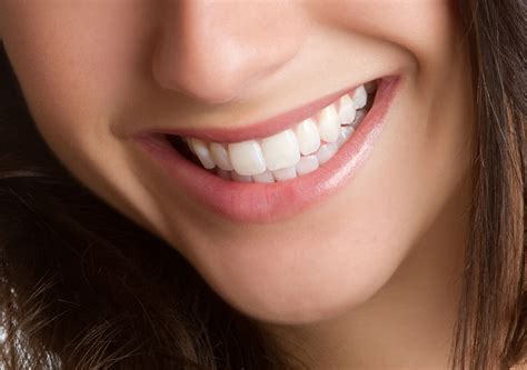 Smile Confidently with Smile Magic McKinney's Teeth Whitening Treatments